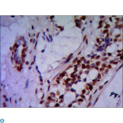 Monoclonal Mouse anti-Human PRMT6 Antibody (WB)