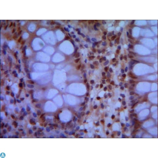 Monoclonal Mouse anti-Human SMC1A / SMC1 Antibody (WB)