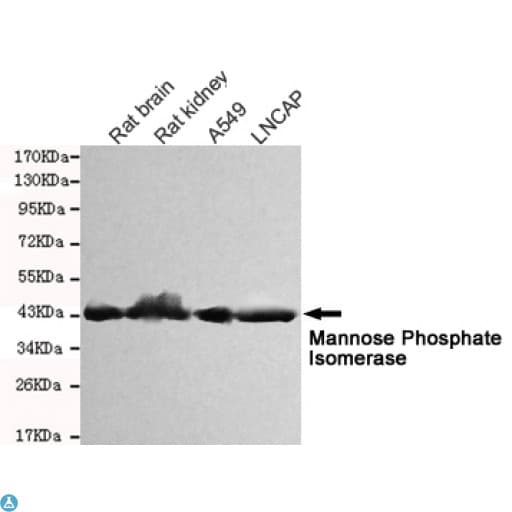 Monoclonal Mouse anti-Human Mannose Phosphate Isomerase Antibody (WB)