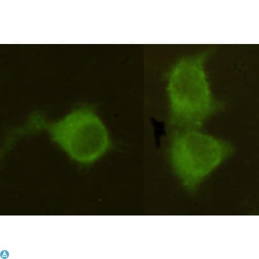 Monoclonal Mouse anti-Human Mannose Phosphate Isomerase Antibody (WB)