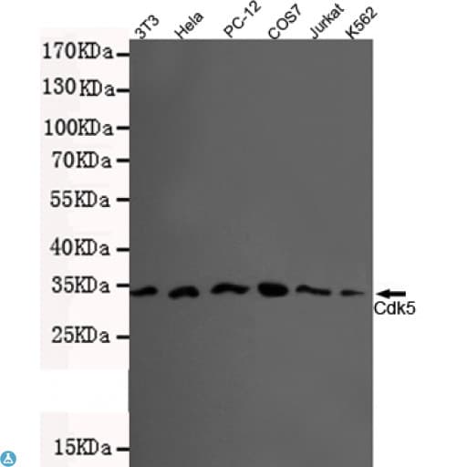 Monoclonal Mouse anti-Human CDK5 Antibody (WB)