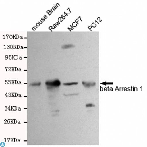 Monoclonal Mouse anti-Human ARRB1 / Beta Arrestin 1 Antibody (WB)