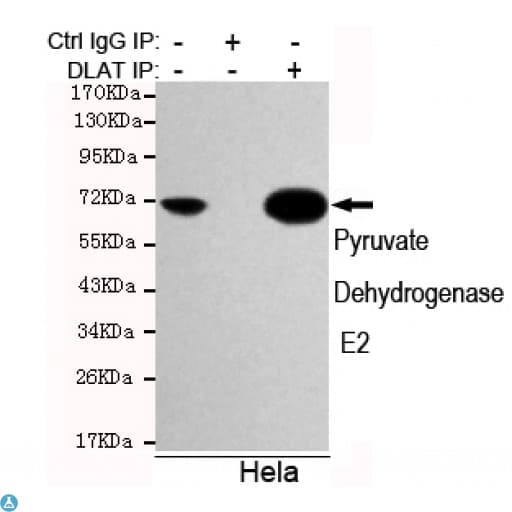 Anti-Pyruvate Dehydrogenase E2 antibody Antibody