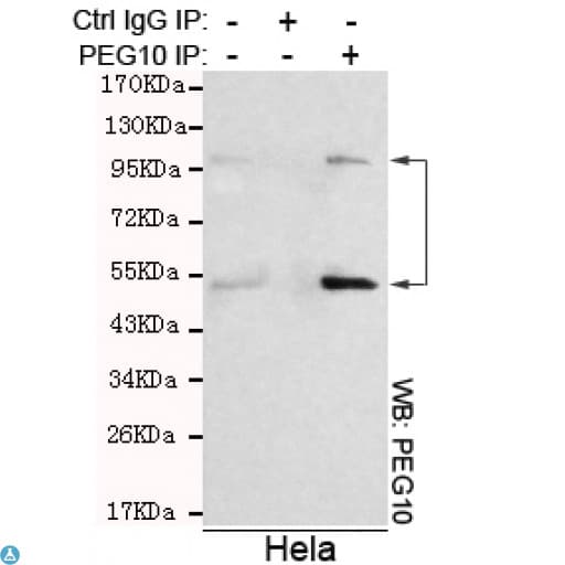 Monoclonal Mouse anti-Human EDR / PEG10 Antibody (WB)