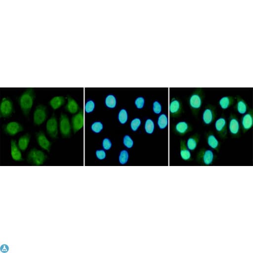 Monoclonal Mouse anti-Human RPA70 / RPA1 Antibody (WB)