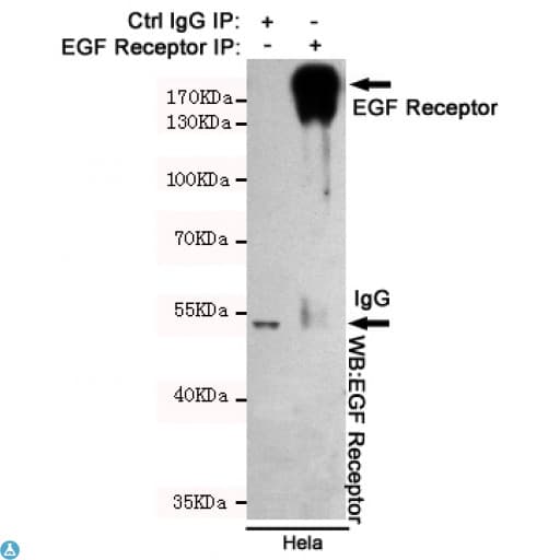Monoclonal Mouse anti-Human EGFR Antibody (WB)