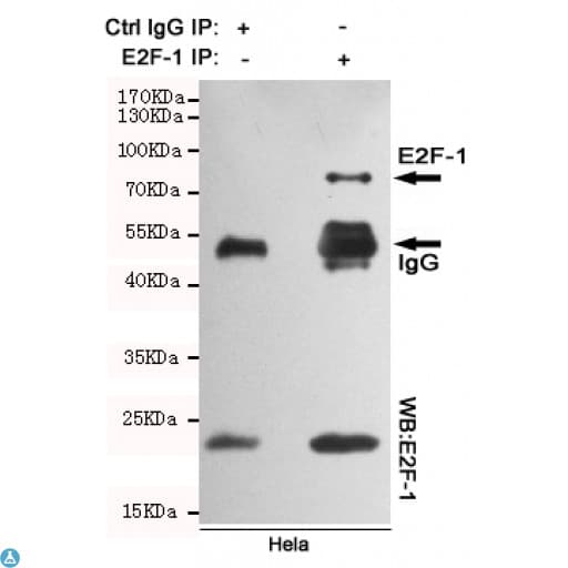 Monoclonal Mouse anti-Human E2F1 Antibody (WB)