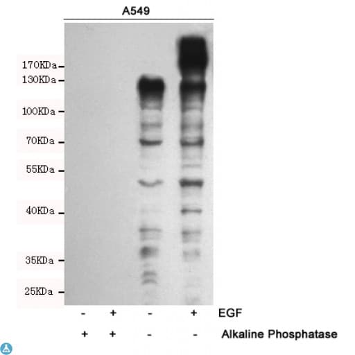 Phosphotyrosine Antibody