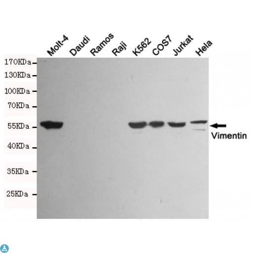 Monoclonal Mouse anti-Human Vimentin Antibody (WB)