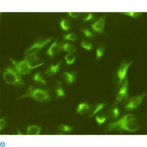 Monoclonal Mouse anti-Human Vimentin Antibody (WB)