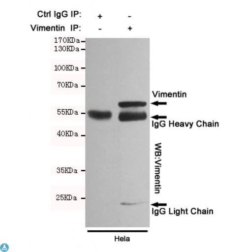 Monoclonal Mouse anti-Human Vimentin Antibody (WB)