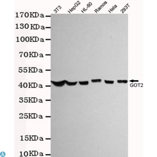 Monoclonal Mouse anti-Human GOT2 Antibody (WB)