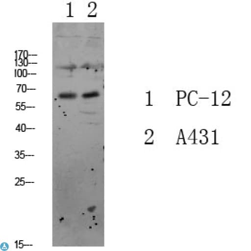 Polyclonal Rabbit anti-Human FOXO3 / FOXO3A Antibody (WB)