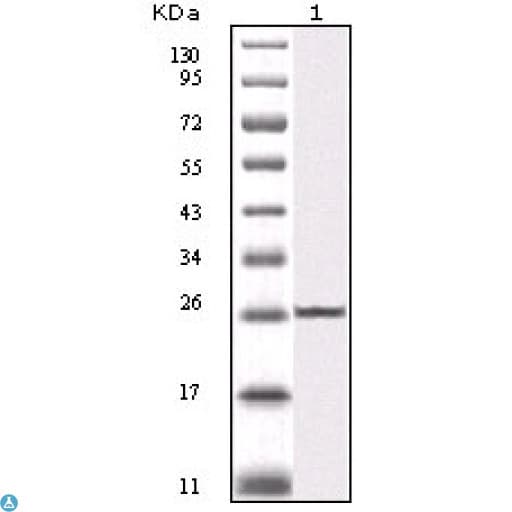 Monoclonal Mouse anti-Human IKBKB / IKK2 / IKK Beta Antibody (IHC, WB)