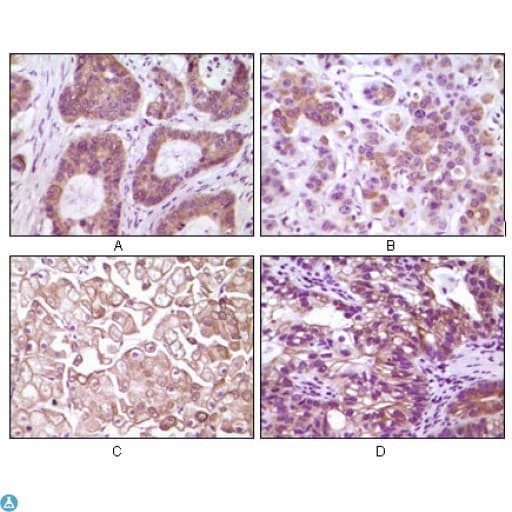 Monoclonal Mouse anti-Human IKBKB / IKK2 / IKK Beta Antibody (IHC, WB)