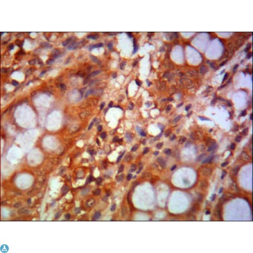 Monoclonal Mouse anti-Human CHD3 Antibody (IHC, IF, WB)