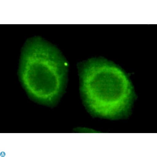 Monoclonal Mouse anti-Human CHD3 Antibody (IHC, IF, WB)