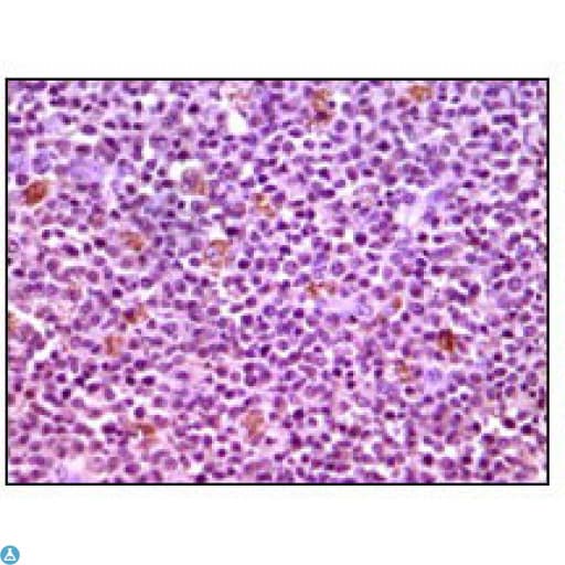 Monoclonal Mouse anti-Human MCL1 / MCL 1 Antibody (IHC, IF, WB)