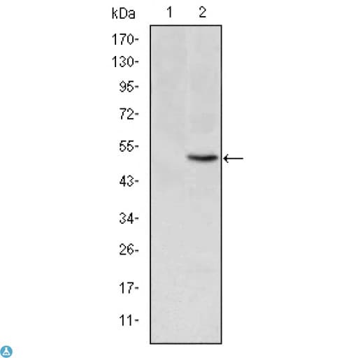Monoclonal Mouse anti-Human MTHFR Antibody (IHC, WB)