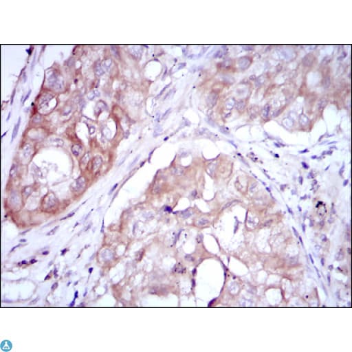 Monoclonal Mouse anti-Human MTHFR Antibody (IHC, WB)