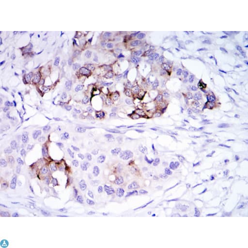 Monoclonal Mouse anti-Human SCGB2A2 / Mammaglobin A Antibody (IHC, IF, WB)
