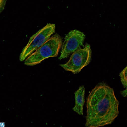 Monoclonal Mouse anti-Human SCGB2A2 / Mammaglobin A Antibody (IHC, IF, WB)