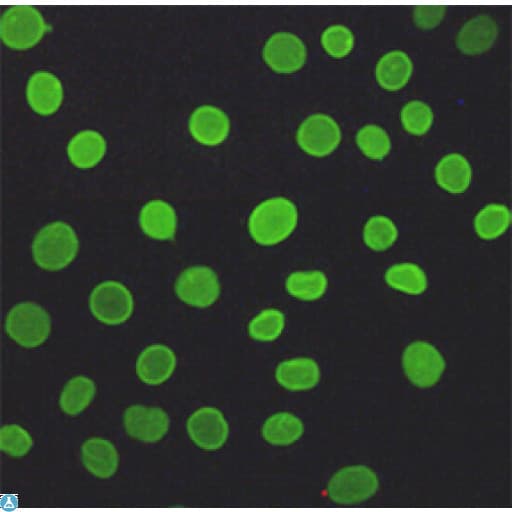 LMNA / Lamin A+C Antibody (clone 5D12-C6-E9)