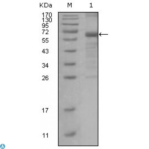 Monoclonal Mouse anti-Human MSH6 Antibody (WB)
