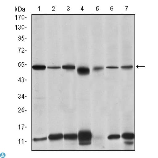 Monoclonal Mouse anti-Human IRAK4 / IRAK-4 Antibody (IHC, WB)