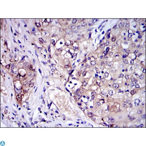 Monoclonal Mouse anti-Human IRAK4 / IRAK-4 Antibody (IHC, WB)