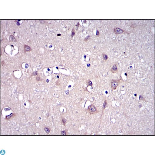 Monoclonal Mouse anti-Human MMP9 / Gelatinase B Antibody (IHC, IF, WB)