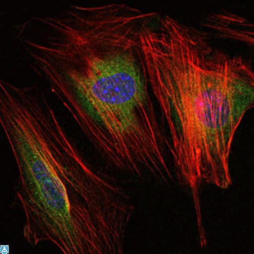 Monoclonal Mouse anti-Human MMP9 / Gelatinase B Antibody (IHC, IF, WB)