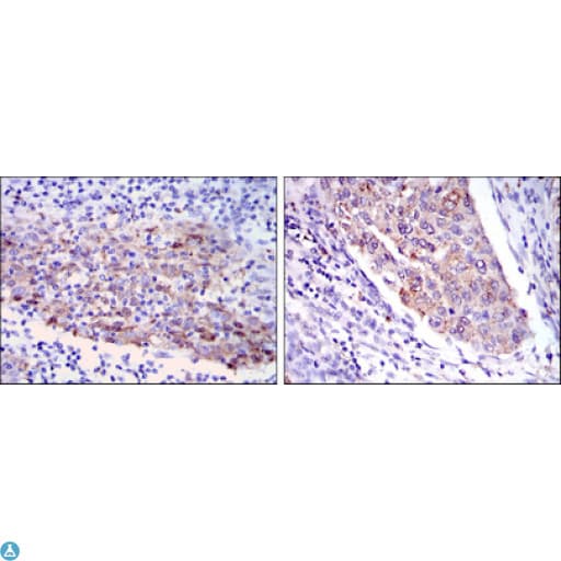 Monoclonal Mouse anti-Human MMP1 Antibody (IHC, IF, WB)