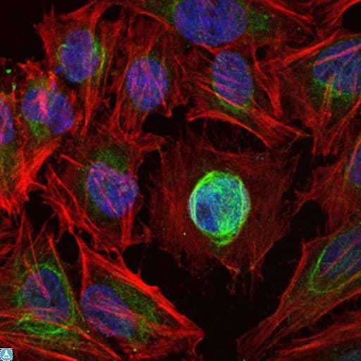 Monoclonal Mouse anti-Human MMP1 Antibody (IHC, IF, WB)