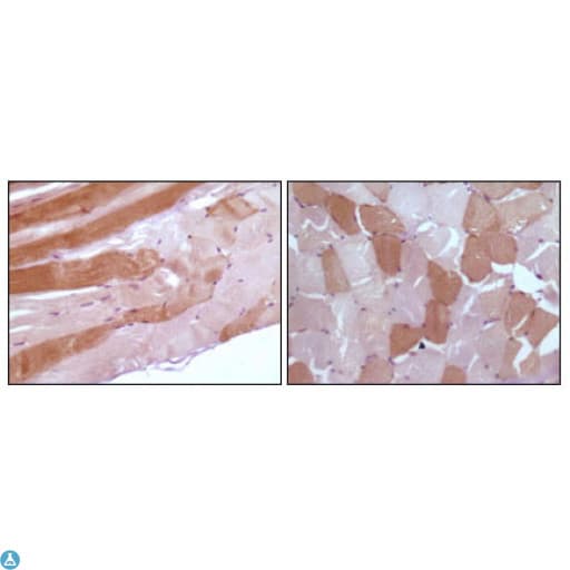 Monoclonal Mouse anti-Human MB / Myoglobin Antibody (IHC, WB)