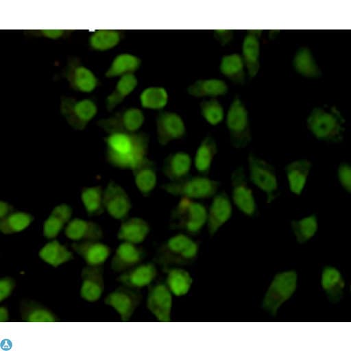 Monoclonal Mouse anti-Human XRCC6 / Ku70 Antibody (WB)