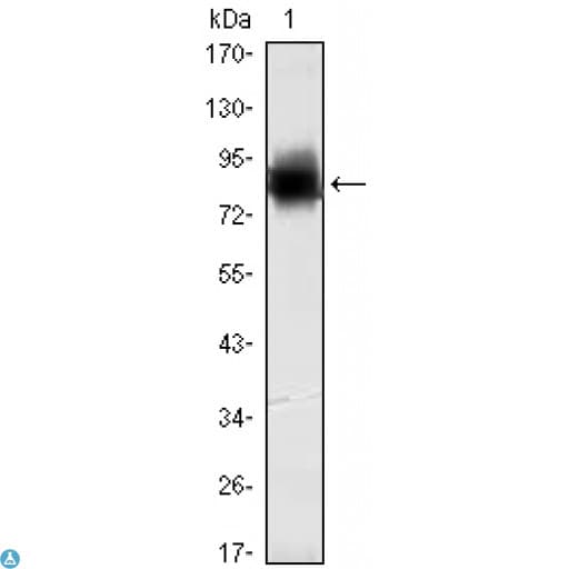 Monoclonal Mouse anti-Human KLHL21 Antibody (IHC, WB)