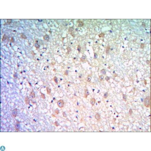 Monoclonal Mouse anti-Human KLHL21 Antibody (IHC, WB)