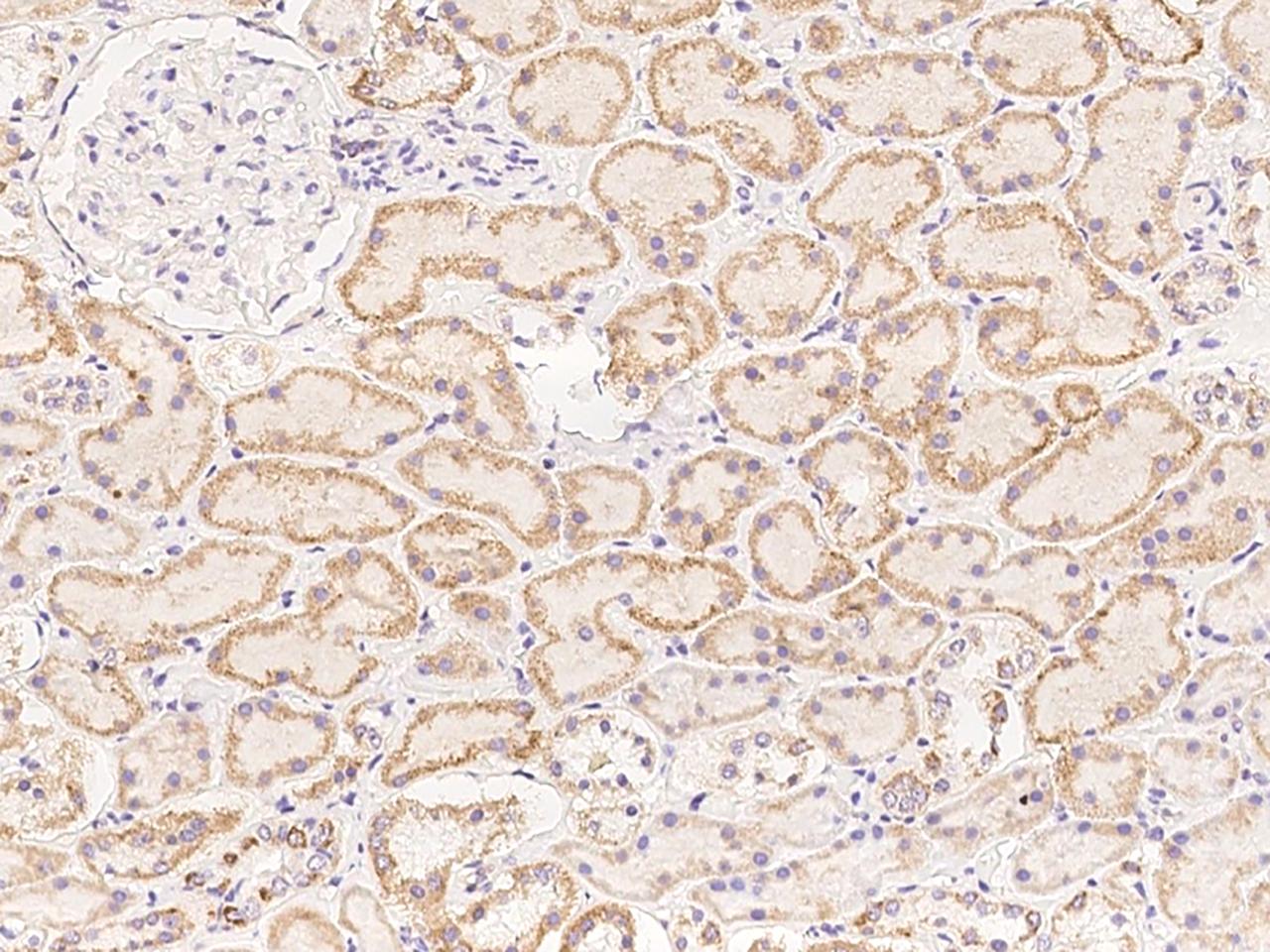 STKLD1 / SgK071 Antibody