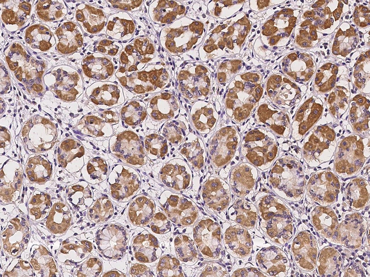CDw218a / IL18R1 Antibody