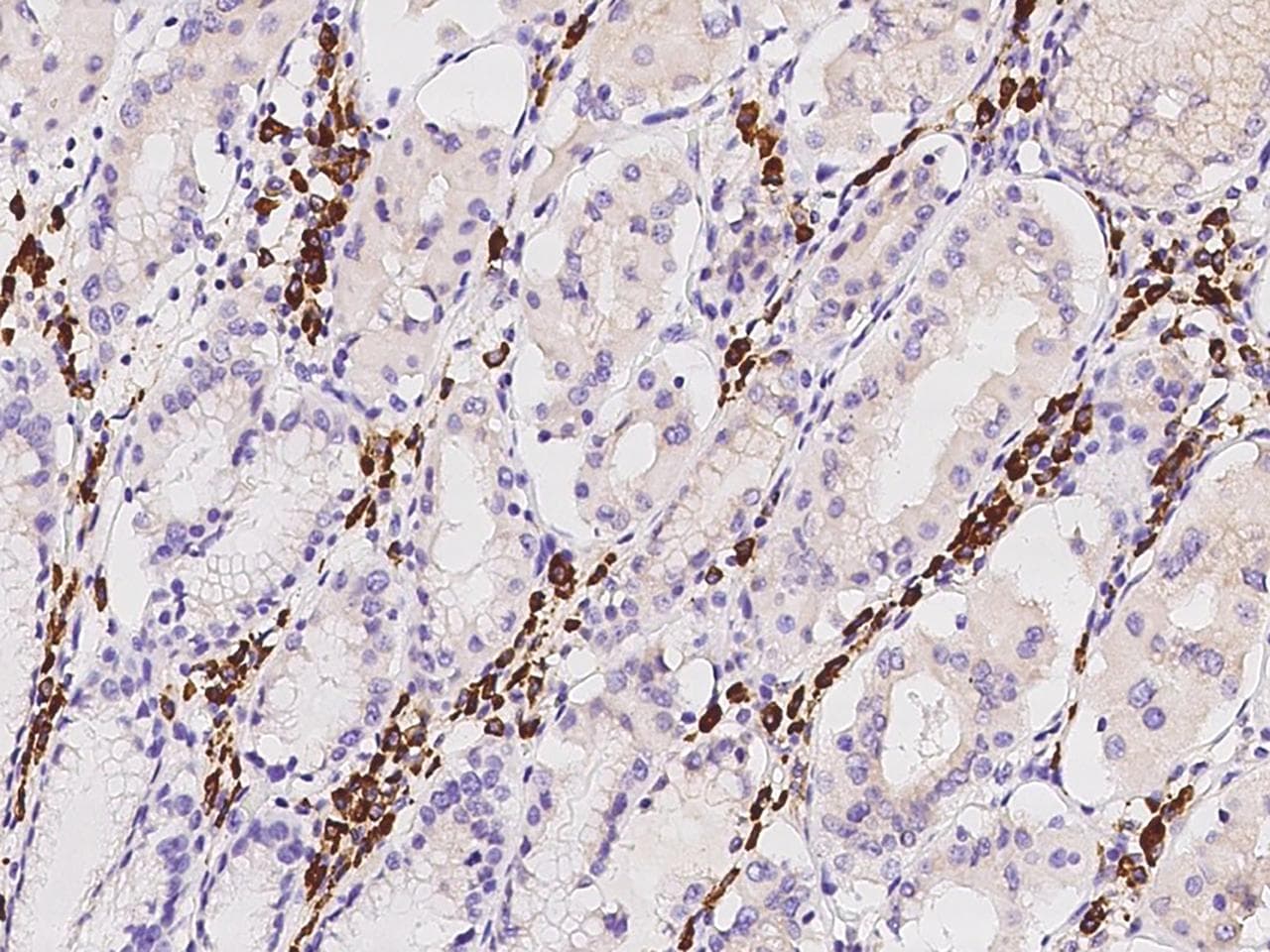 TXNDC5 / ERP46 Antibody