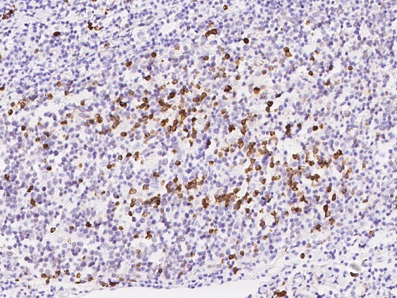 TXNDC5 / ERP46 Antibody