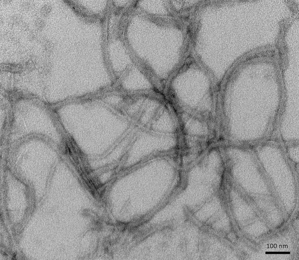Human MAPT / Tau Protein (Recombinant)