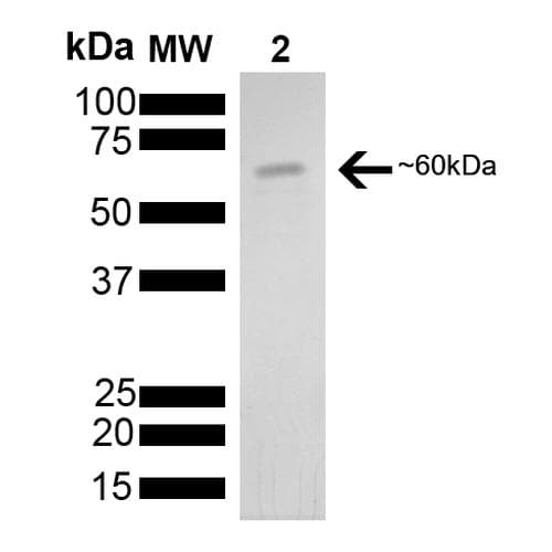 Human HSPD1 / HSP60 Protein (Recombinant His)