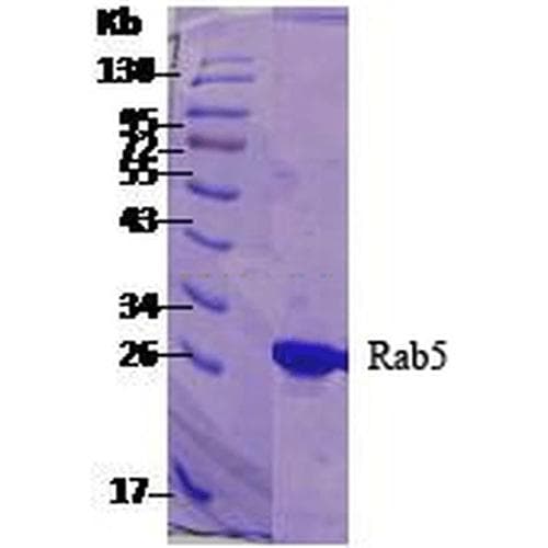 Human RAB5A / RAB5 Protein (Recombinant His)