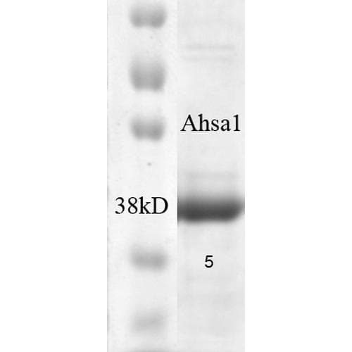 Human AHSA1 / AHA1 Protein (Recombinant)