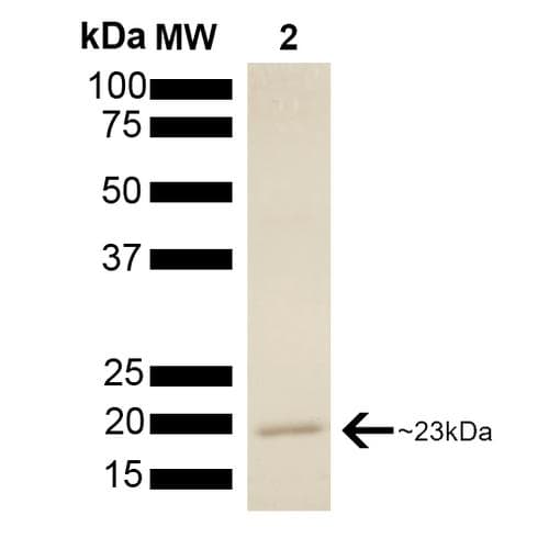 Human PTGES3 / p23 Protein (Recombinant)