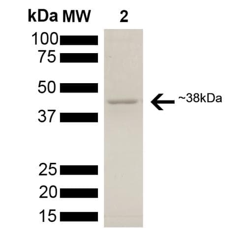 Human AHSA1 / AHA1 Protein (Recombinant His)