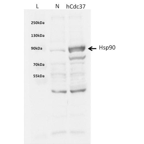 Human CDC37 Protein (Recombinant His)