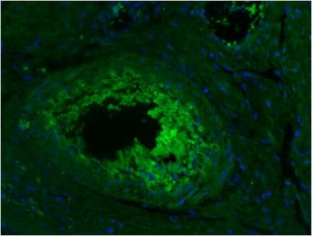 CD45 / LCA Antibody (clone YTH 80.103, Azide-free)